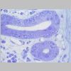 Intestino Delgado 18.jpg